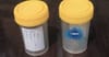 NBN Mail Out Urine Sample Jars As They Begin To Literally Take The Piss