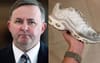 Anthony Albanese MP Reportedly So Off It After Some Gronk Scuffed His TNs