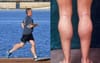 Bill Shorten Under Fire For Allegedly Spending Campaign Funds On Calf Implants