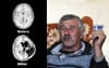 Scans Reveal What Damage Free-To-Air Sky News Has Done To This Country Father’s Brain
