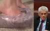 Senator Malcolm Roberts Says Wearing Tissue Boxes On His Feet Has Kept Him Safe During Pandemic