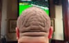 Report: Man Blocking View Of TV In The Front Bar Is British By The Look Of His Head