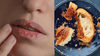 Winter Winds Leave Local Girl’s Lips Flaking Like Twice Baked Croissants