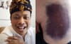 Australia Outraged And Demanding Answers After Ketut Is Shot In The Arse With A Rubber Bullet