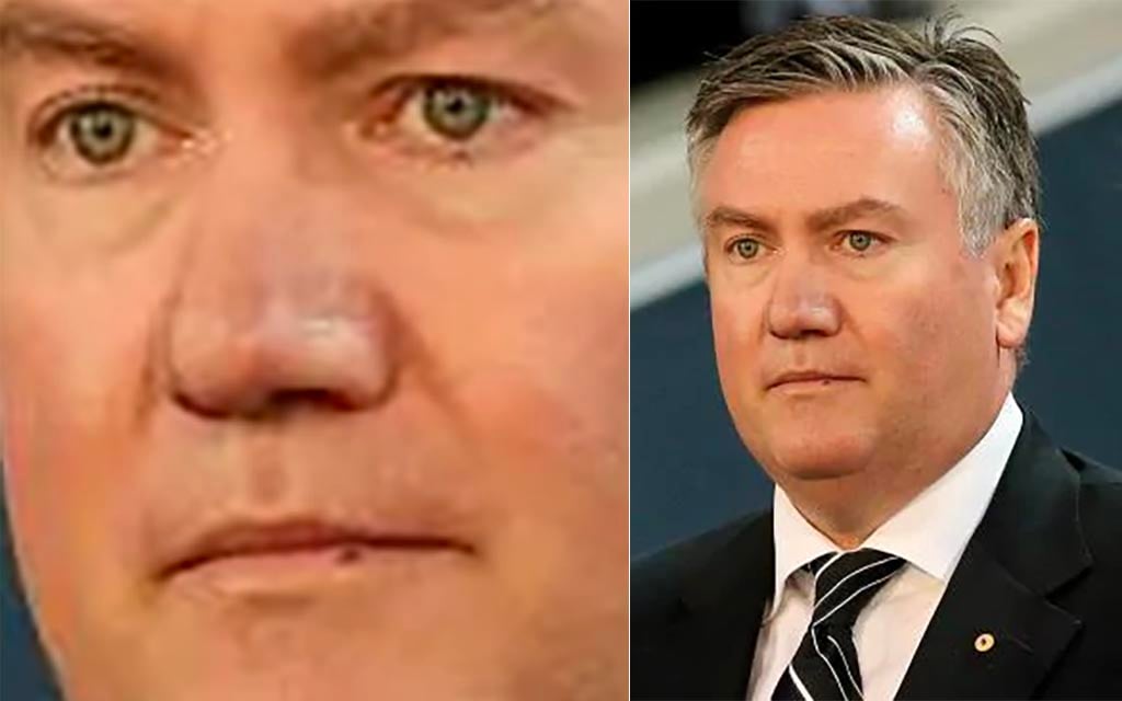 Nation Collectively Laughs At Eddie McGuire — Again